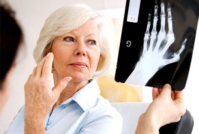 The two most common forms of arthritis